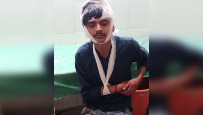 Kalyan crime : झोपलेल्या वॉचमनवर अज्ञातांकडून जीवघेणा हल्ला