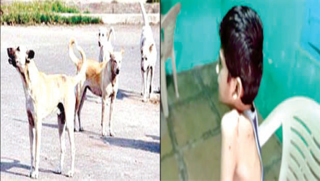 मोकाट कुत्र्यांच्या हल्ल्यात विद्यार्थी जखमी,www.pudhari.news