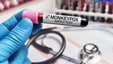 Monkeypox Case
